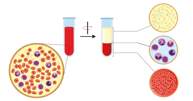 La centrifugation